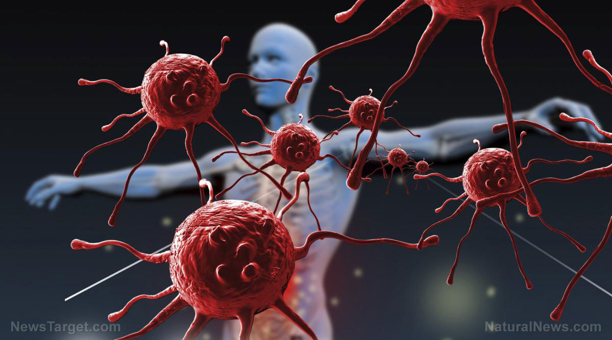 Rise of the superbugs: Bacteria are outsmarting humans. Will they eventually kill us all?