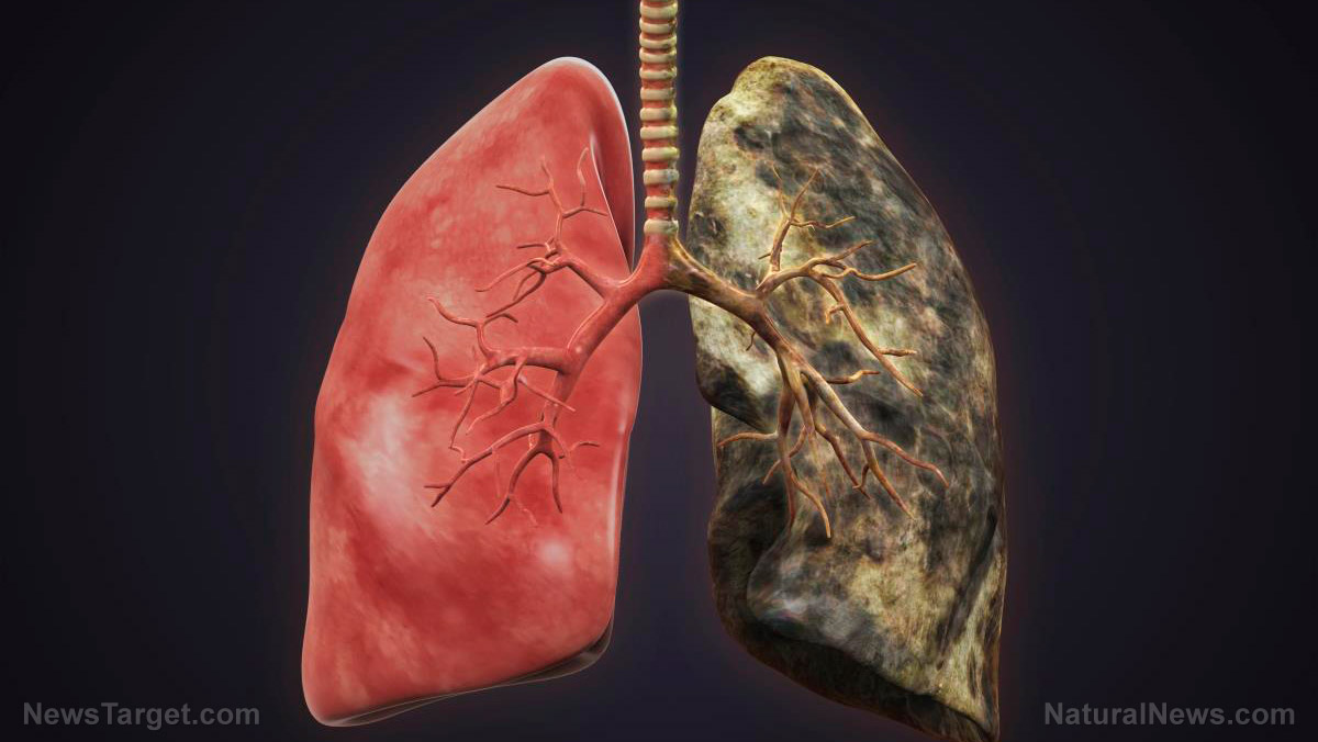 Similarities and differences between emphysema and chronic bronchitis, two conditions that fall under COPD