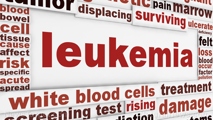 Warning: Chemo may be linked to cancer relapses in patients with leukemia
