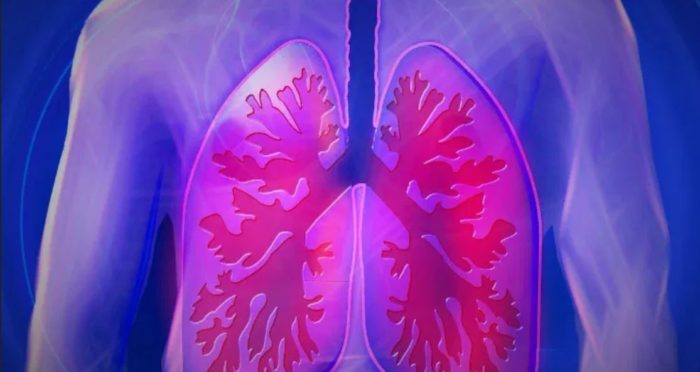 Long-Term Mask Use May Contribute To Advanced Stage Lung Cancer, Study Finds