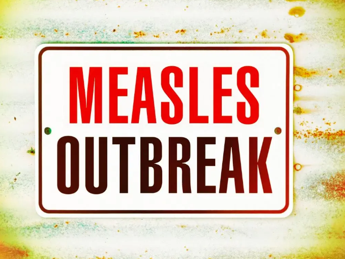 Measles by the numbers – perspective to the panic