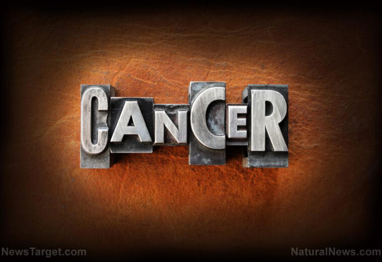 5 Personal strategies to minimize cancer risk, as shared by an oncologist